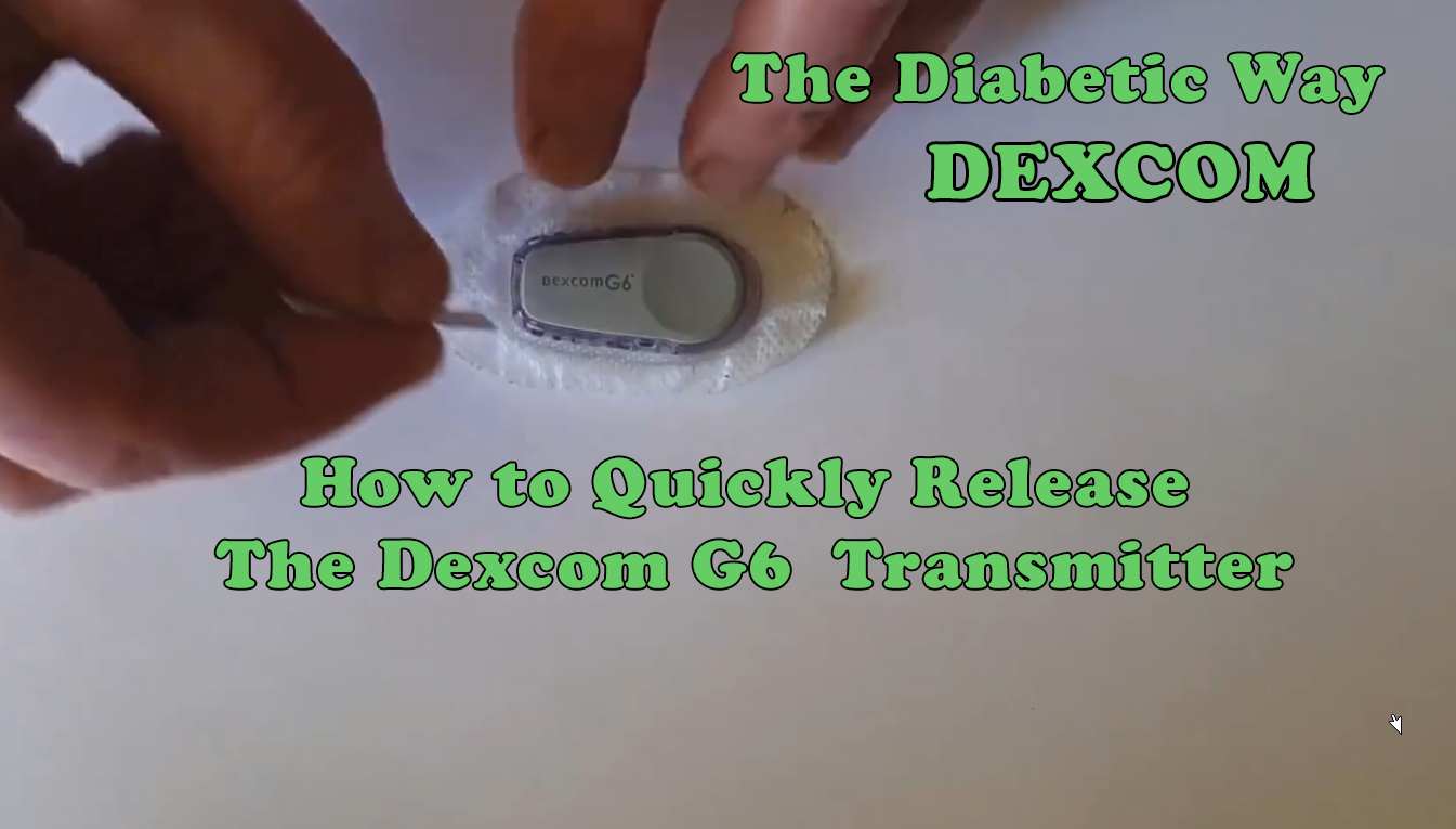 The Diabetic Way - How to Quickly Release The Dexcom G6 Transmitter